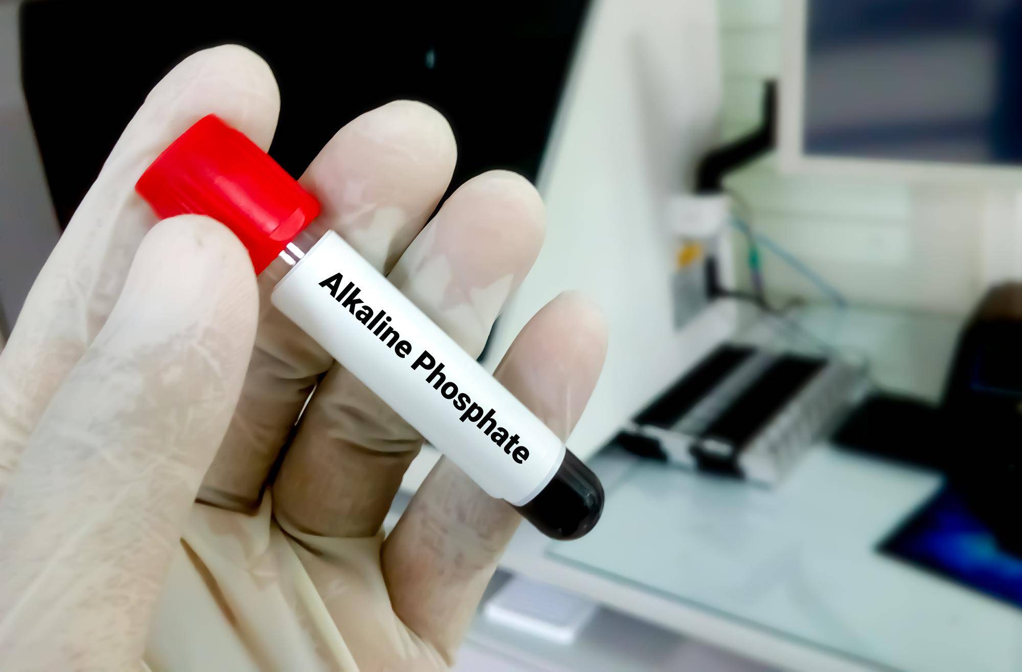 Braltus czy to steryd analiza działania i zastosowania